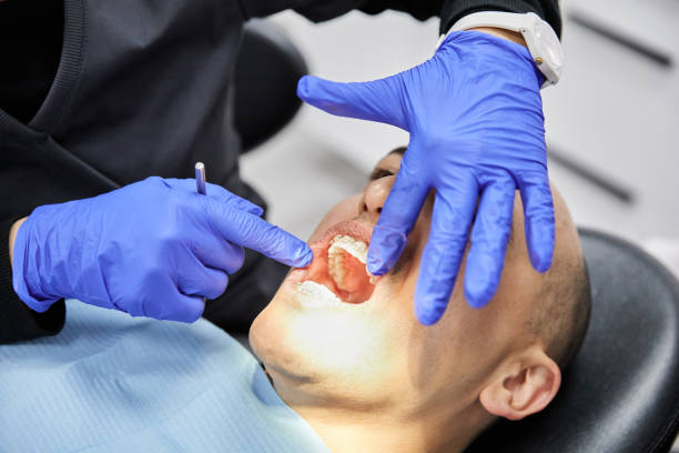 Best Same-Day Emergency Dental Services in Cherryland, CA