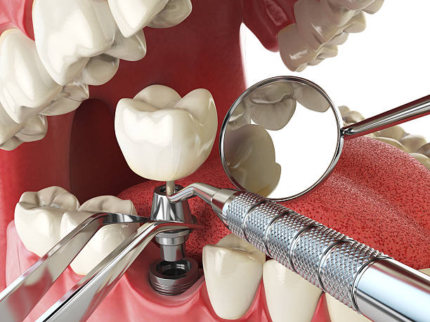 Best Emergency Denture Repair in Cherryland, CA
